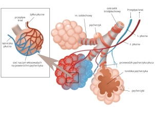 Zarostowe Zapalenie Oskrzelików ilustracja, Bronchiolitis Obliterans płuca medyczne - Zarostowe zapalenie oskrzelików | Pulmonologia - mp.pl