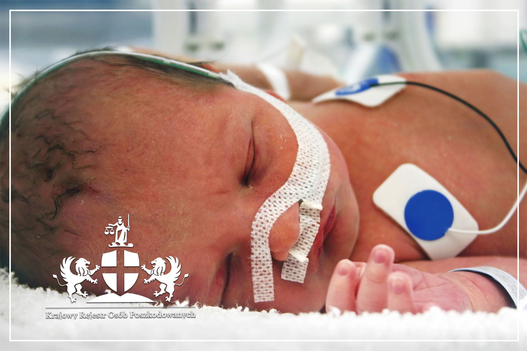 Niedotlenienie płodu, hipoksja u dziecka, brak tlenu w łonie, zagrożenie rozwojowe, płód pępowina, tlen dla dziecka - Niedotlenienie płodu w ciąży objawy, postępowanie i skutki