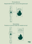 conduction vs convection phone